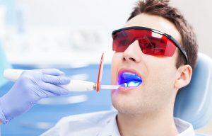 Laser Dentistry in San Jose